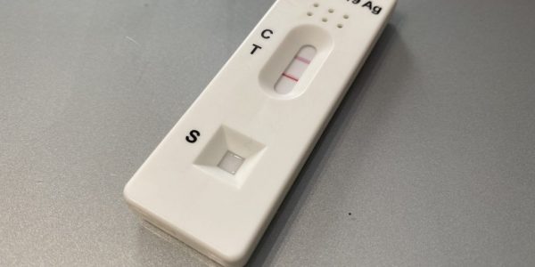 Test de antígenos para la covid